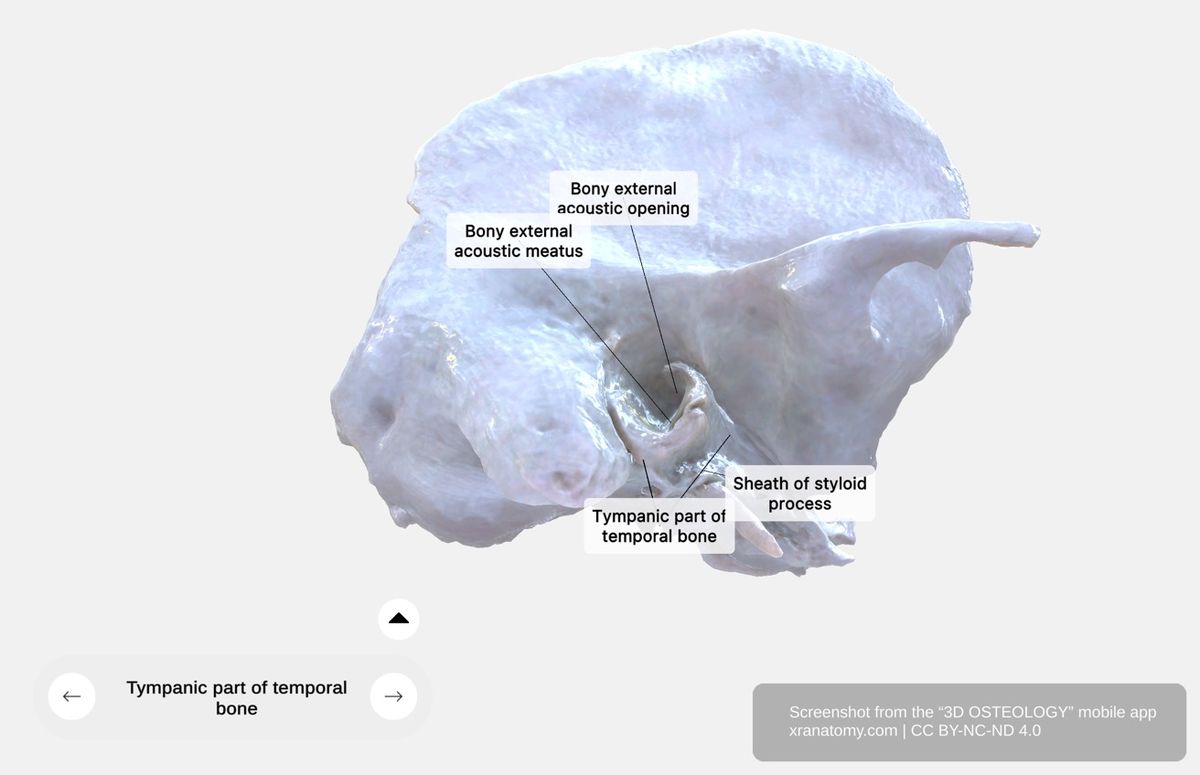 Tympanic part of temporal bone 360-degree viewer showing external acoustic meatus, tympanic sulcus, and styloid process sheath